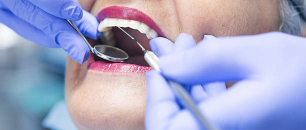 Best Emergency Dentist for Knocked-Out Tooth in Bennett, CO